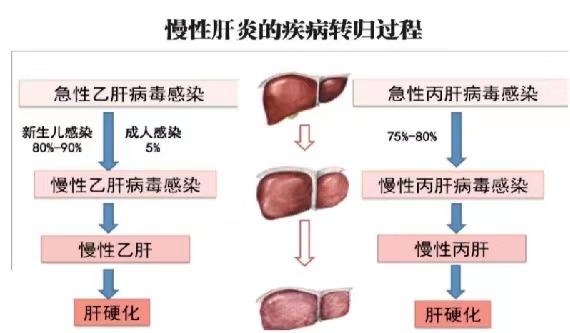 【健康科普】世界肝炎日——堅持早預(yù)防，加強檢測發(fā)現(xiàn)，規(guī)范抗病毒治療